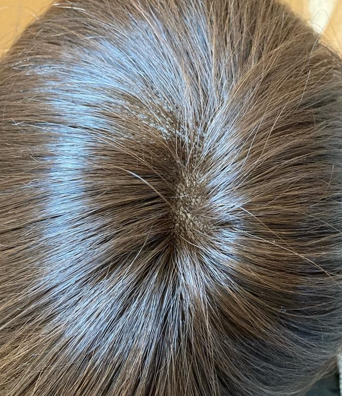 もんちゃん　マダムヒロコ　ハンドメイド　人毛MIX　ビューティフルショート