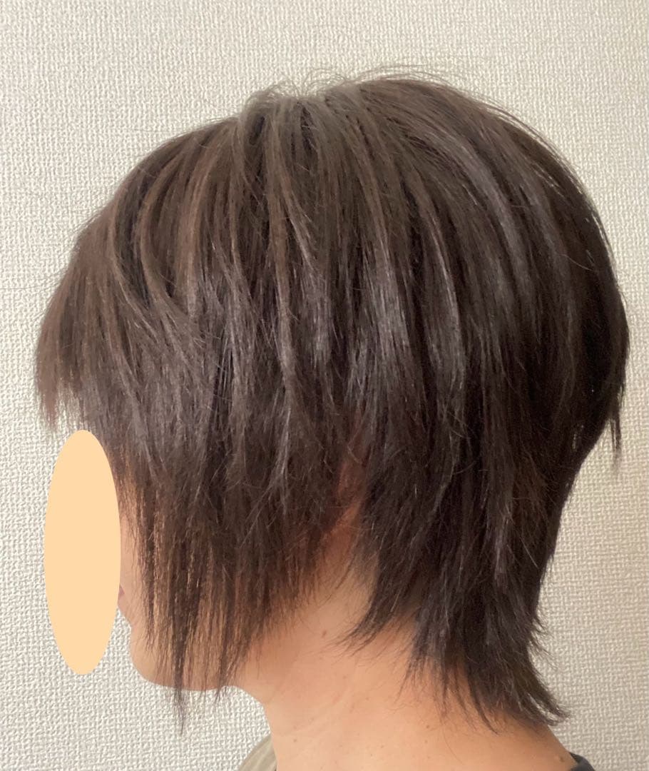 アデランス FONTAINE 医療用ウィッグ FO4 F4人毛+合成繊維