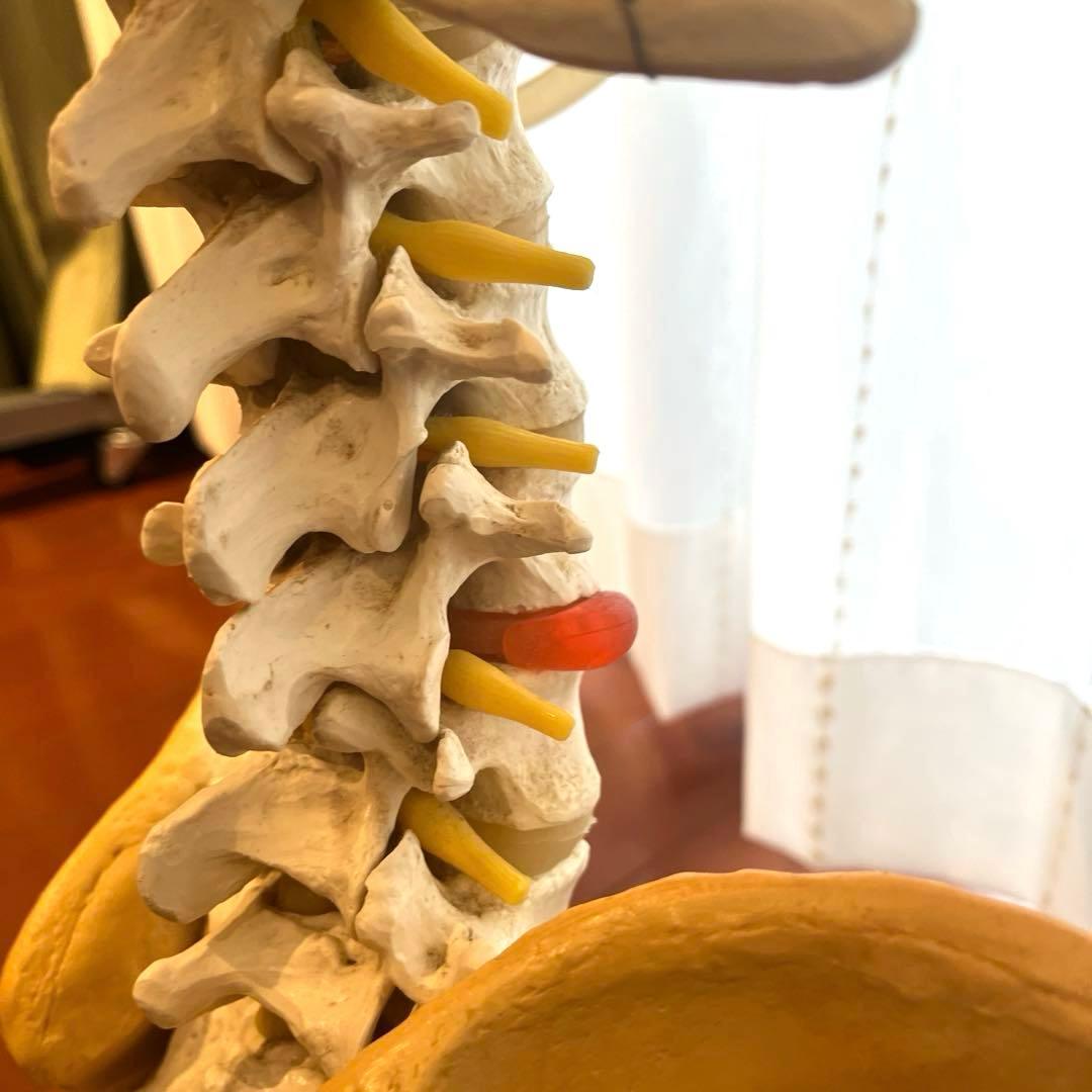 脊柱可動型モデル，胸郭，大腿骨付 3B Smart Anatomy