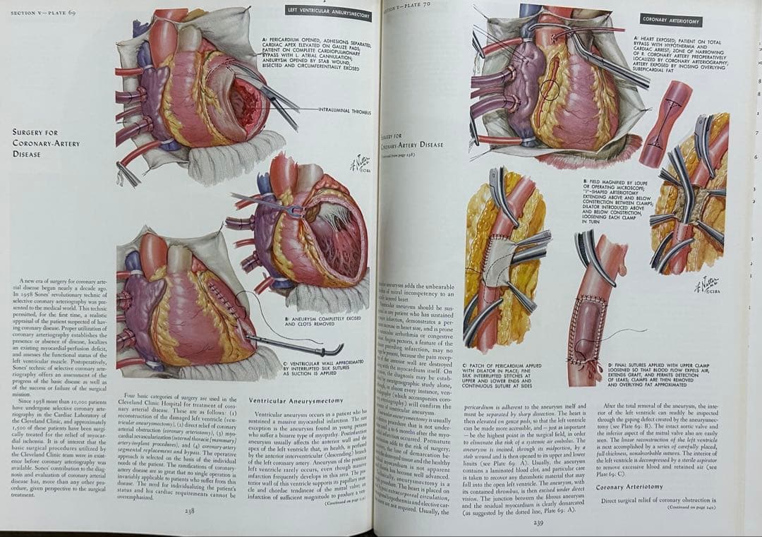 CIBA医学イラスト集 1、2、3(1-2-3)、4、5 /フランクH.ネッター