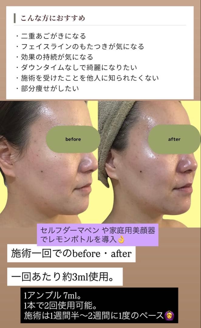 くじら　レモンボトル×3本