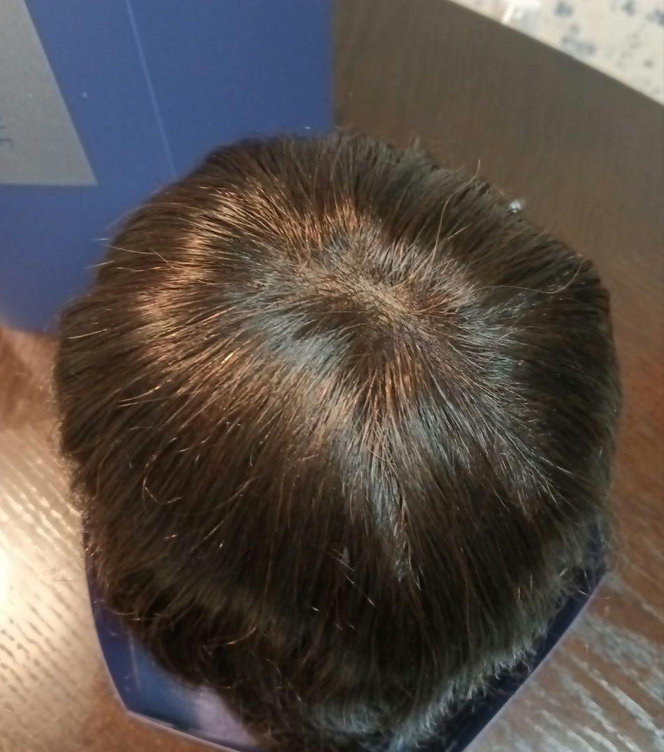 フォンテーヌ トップピース