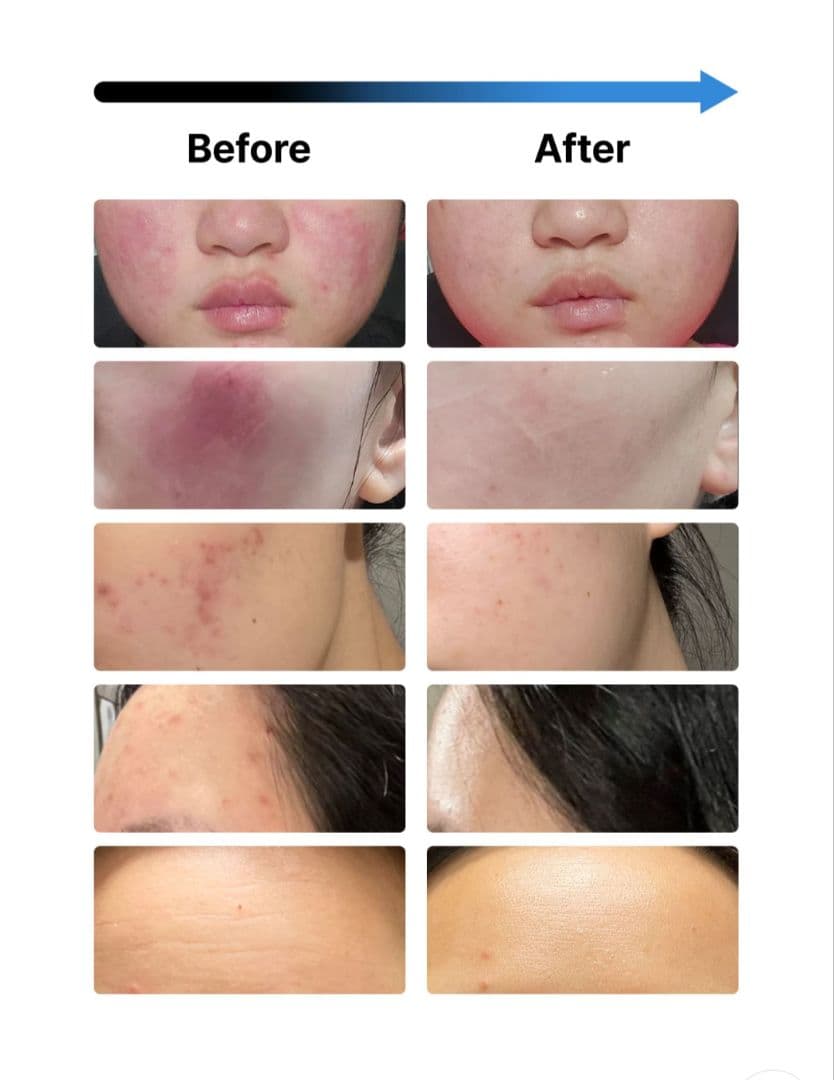 水光肌！　【プレミアムエステ体験】