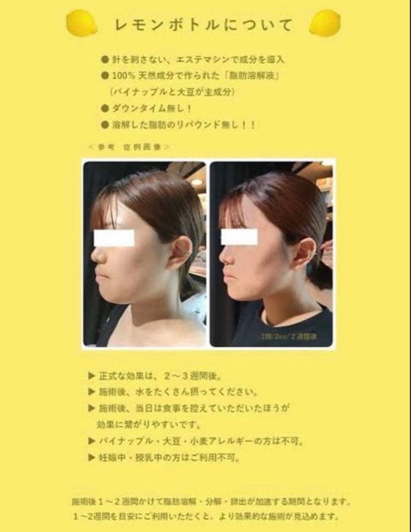 みゆ　レモンボトル3本