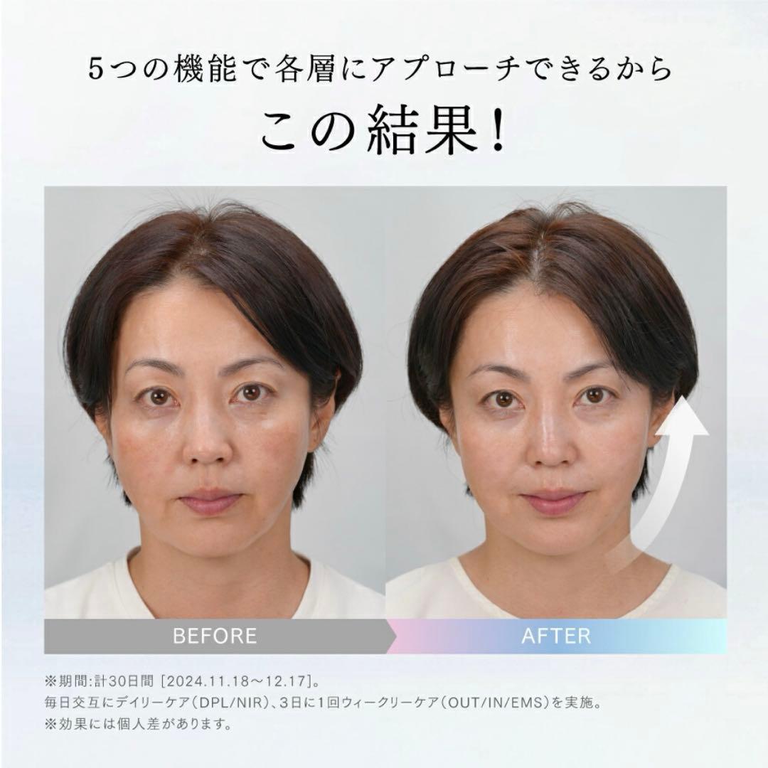 【新品未使用】MYTREX MiRAY ONE