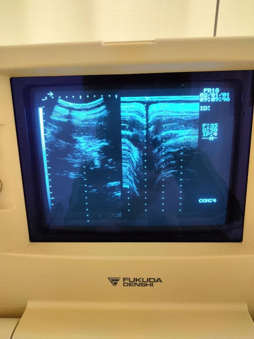 超音波　画像診断　エコー　フクダ電子UF-4100M