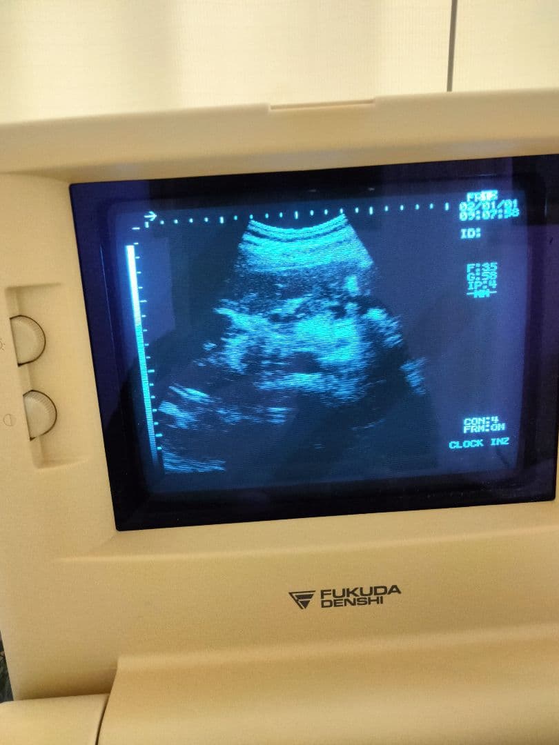 超音波　画像診断　エコー　フクダ電子UF-4100M