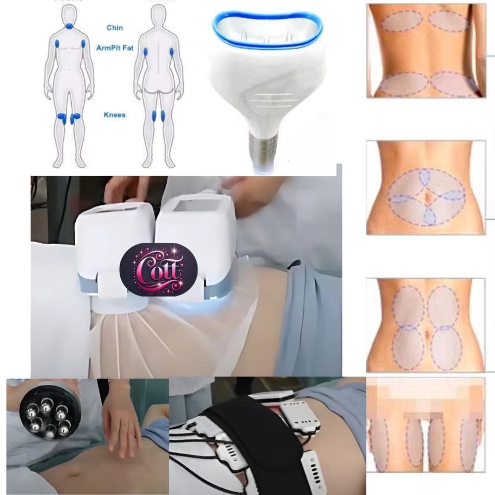 脂肪冷却マシン 3ハンドル搭載 非侵襲型痩身 RF/レーザー/キャビテーション付