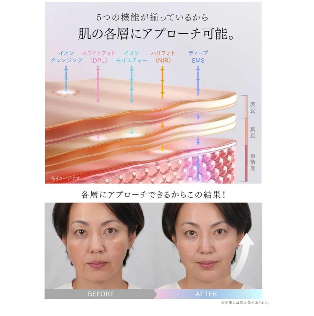 マイトレックス MiRAY ONE 美顔器 ホワイトフォト DPL ハリフォト