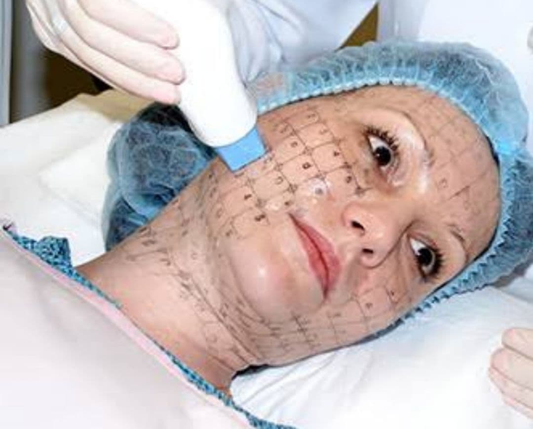 ボディ・フェイスケア THEREMAGE