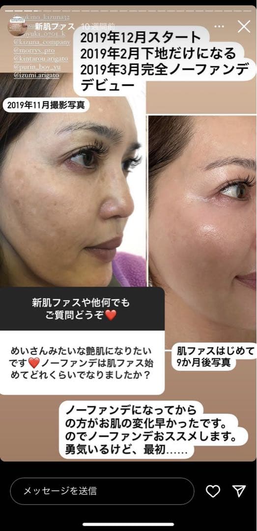 【新品、未開封】モリーズプロ 薬用ホワイトニングクリーム