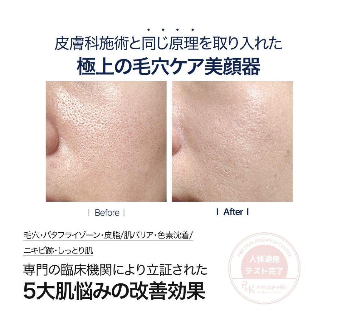 ペンタショット 美顔器