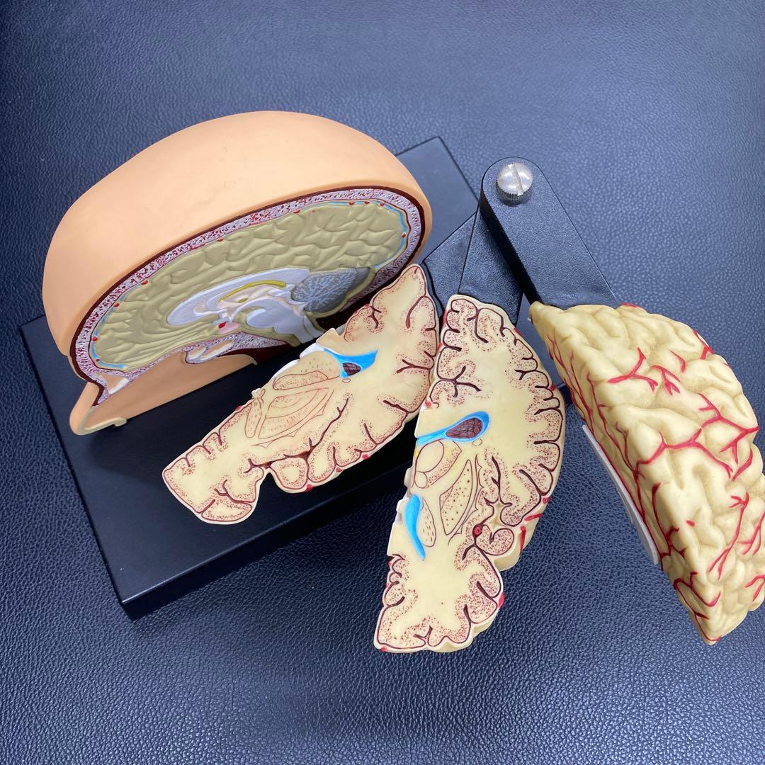 脳模型 約14cm x 20cm x14cm