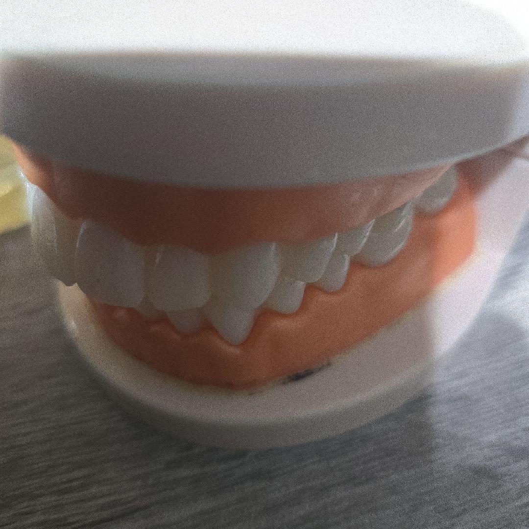 2個 歯列模型 実物大 開閉式 乳歯期 永久歯萌出前 永久歯 交換期 模型 歯科