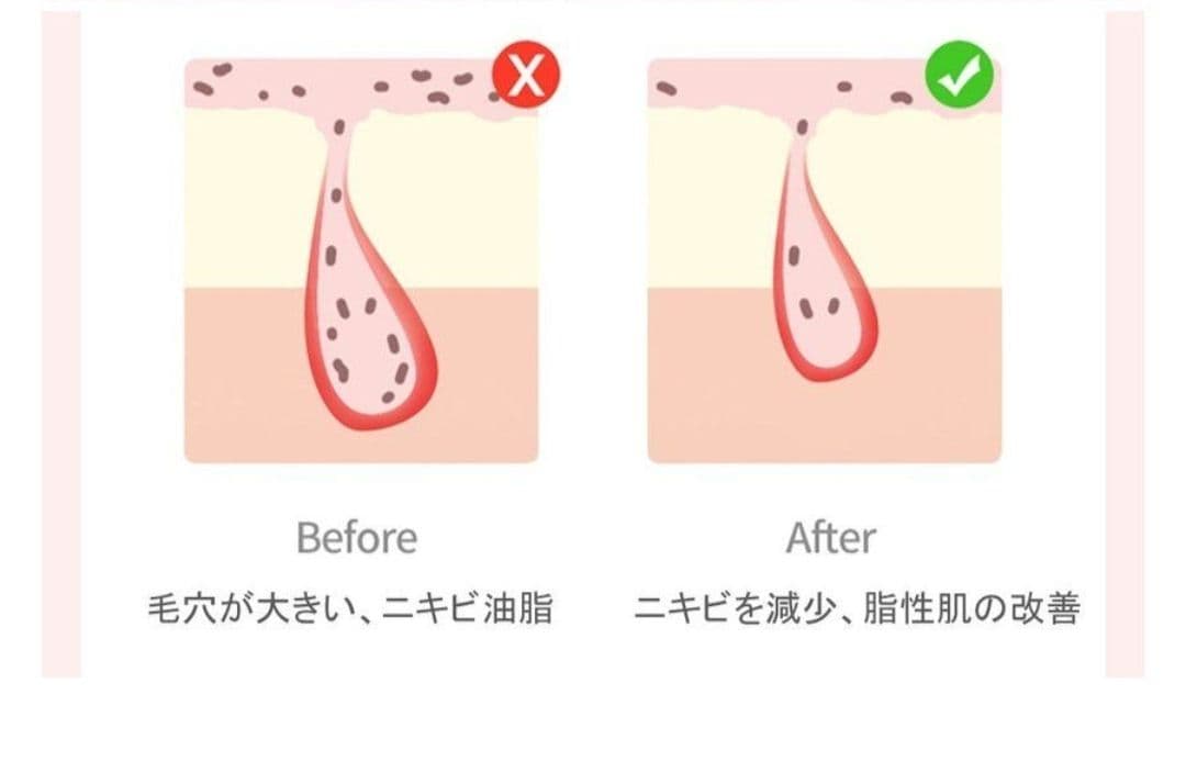 ★値下げ★LED美顔器　光照射　美白　ニキビ　ハリ　育毛