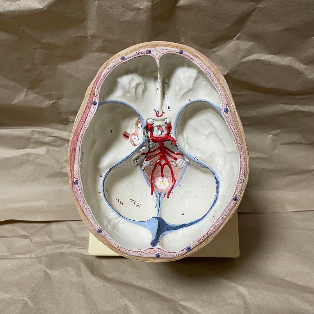 脳模型 医学 3B 9分解モデル ドイツ製