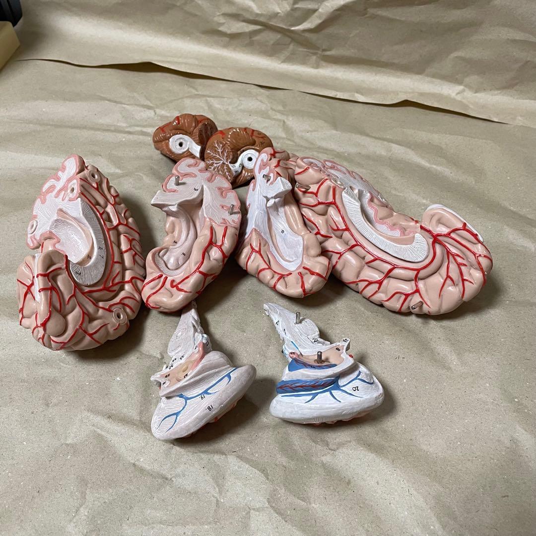 脳模型 医学 3B 9分解モデル ドイツ製