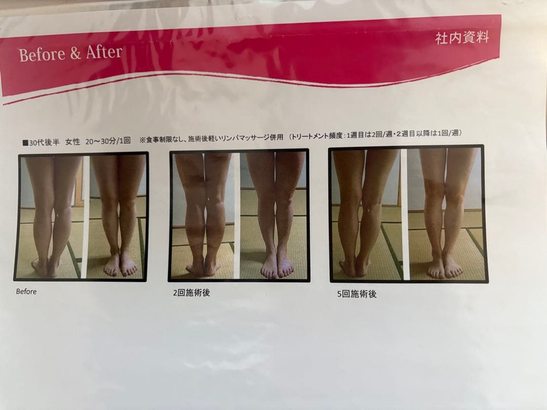 はな ★ 大手エステサロン導入品　業務用　キャビコンパクト