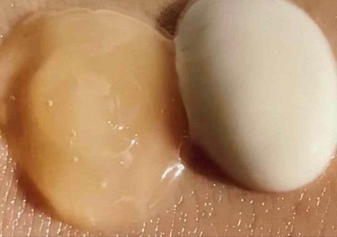 ナリス化粧品　 セルグレース　 フォーミュラセット