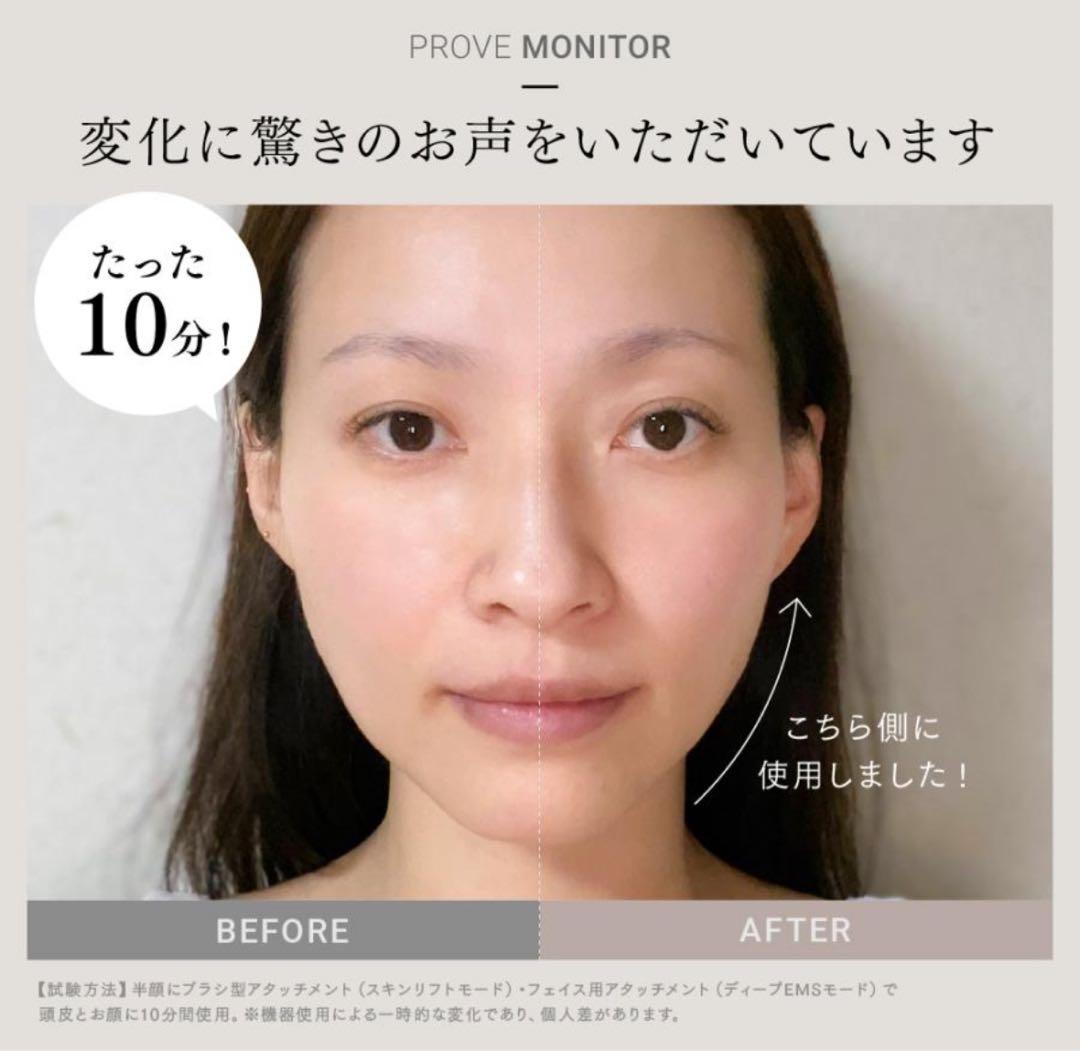 最安値　美顔器 EMS MYTREX トータルリフト美顔器　新品