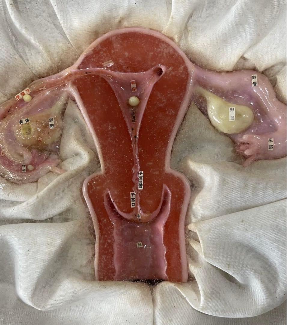 1、医療用 模型 子宮 解剖学的女性生殖器模型 木製ケース入り 送料込みで発送